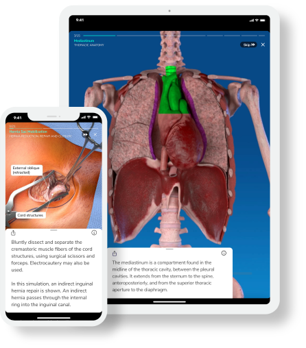 Touch Surgery interactive surgical simulations on tablet and phone